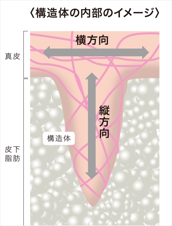 たるみの原因の構造体模式図2